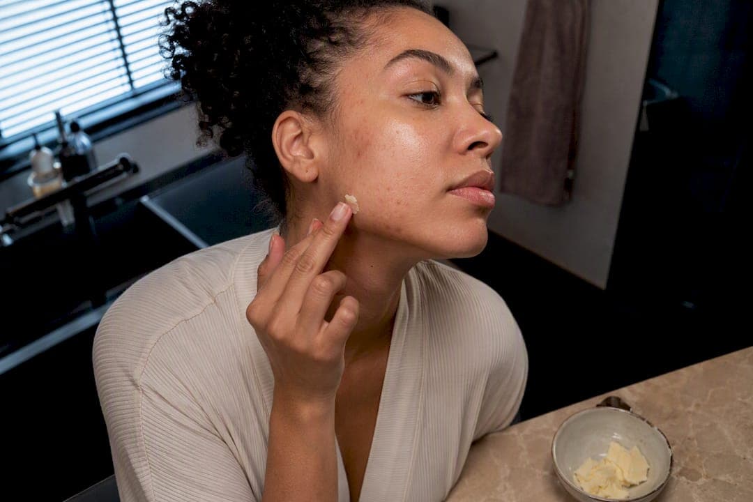 Rated 0–2: Is Shea Butter Comedogenic for Acne Prone Skin?